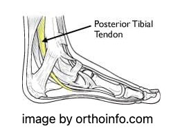 orthoinfo Barking Dog Shoes reviews and recommends the best footwear for people with various foot issues (as well as for women with average feet for whom comfort is a high priority).